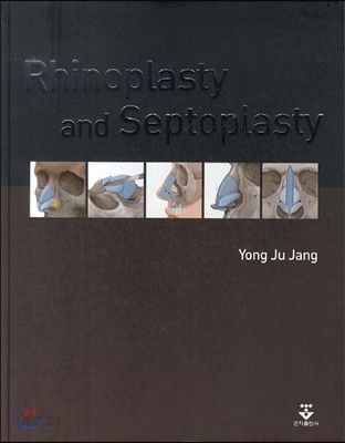 Rhinoplasty and Septoplasty