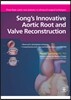 Song's Innovative Aortic Root and Valve Reconstruction