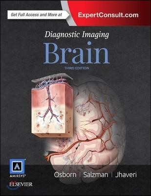 Diagnostic Imaging: Brain