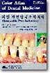 [중고-중] 최신 가철성국소의치학