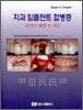 치과 임플란트 합병증