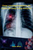 Deep Learning Frameworks for COVID-19 Chest X-Ray Analytics