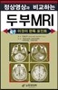 [중고-상] 정상영상과 비교하는 두부 MRI