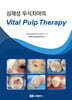 심재성 우식치아의 Vital Pulp Therapy