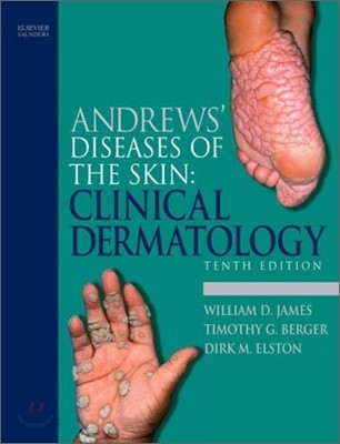 Andrews&#39; Diseases of the Skin Clinical Dermatology