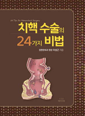 치핵 수술의 24가지 비법
