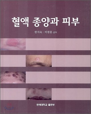 혈액종양과 피부