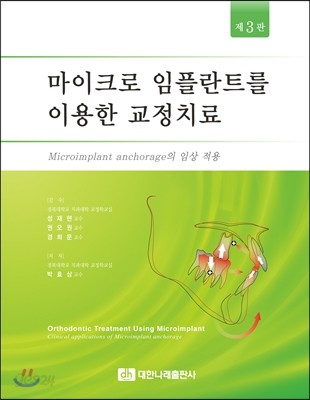 마이크로 임플란트를 이용한 교정치료 