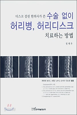 디스크 걸린 한의사가 쓴 수술없이 허리병, 허리디스크 치료하는 방법