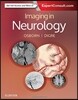Imaging in Neurology