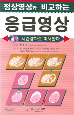 정상영상과 비교하는 응급영상