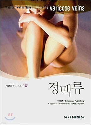 정맥류