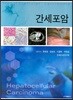 간세포암