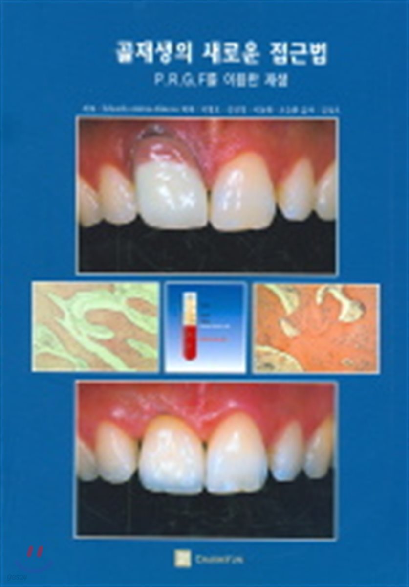 골재생의 새로운 접근법 (P.R.G.F를 이용한 재생)