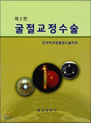 굴절교정수술