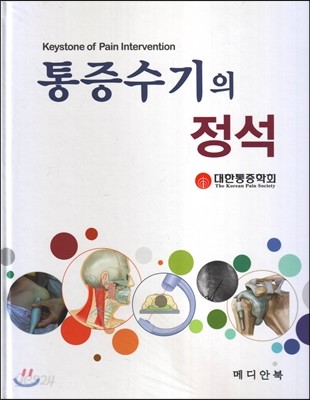 통증수기의 정석