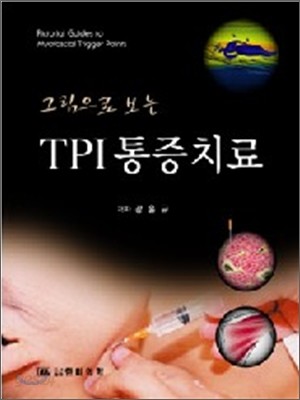 TPI 통증치료