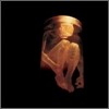 Alice In Chains - Nothing Safe: Best Of Box