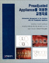 Preadjusted Appliance를 이용한 교정치료