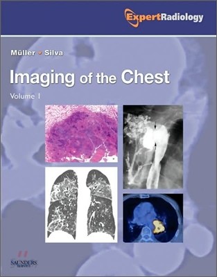 Imaging of the Chest (2 Vols)