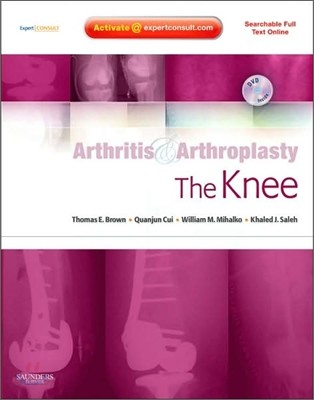 Arthritis and Arthroplasty