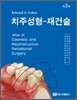 치주성형-재건술