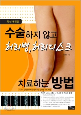 수술하지 않고 허리병, 허리디스크 치료하는 방법