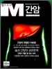 간암