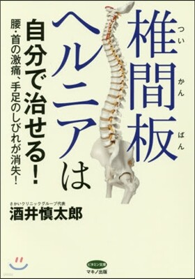 椎間板ヘルニアは自分で治せる!