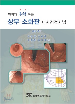 상부 소화관 내시경검사법