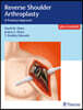 Reverse Shoulder Arthroplasty