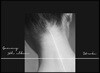 거미 5집 - Stroke