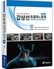 갑상선 초음파와 중재