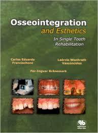 Osseointegration And Esthetics In Single Tooth Rehabilitation (Hardcover, 1st) 