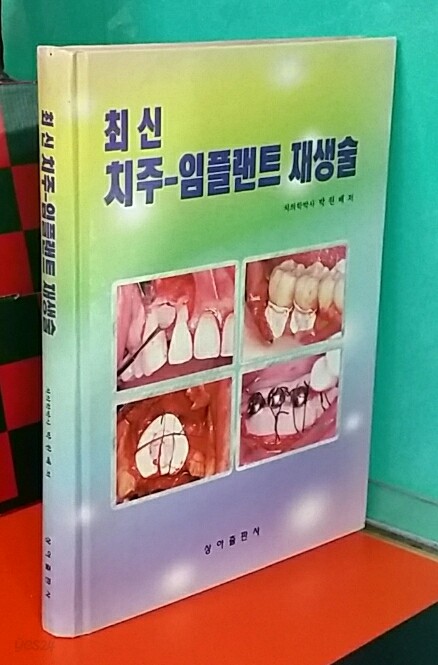 최신 치주 임플랜트 재생술