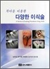 다양한 이식술