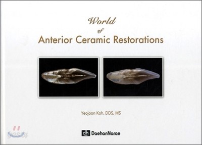 WORLD OF ANTERIOR CERAMIC RESTORATIONS