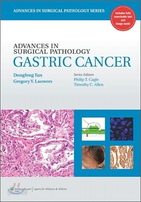 Advances in Surgical Pathology : Gastric Cancer