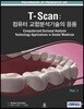 T-Scan: 컴퓨터 교합분석기술의 응용