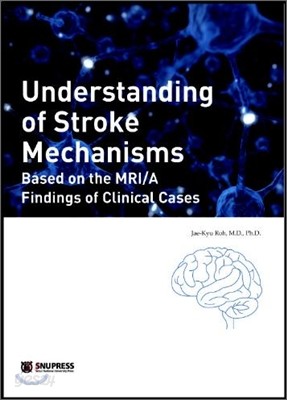 Understanding of Stroke Mechanisms