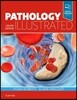 Pathology Illustrated
