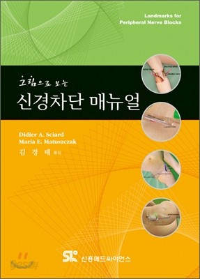 그림으로 보는 신경차단 매뉴얼