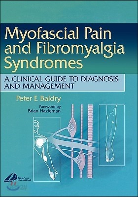 Myofascial Pain and Fibromyalgia Syndromes