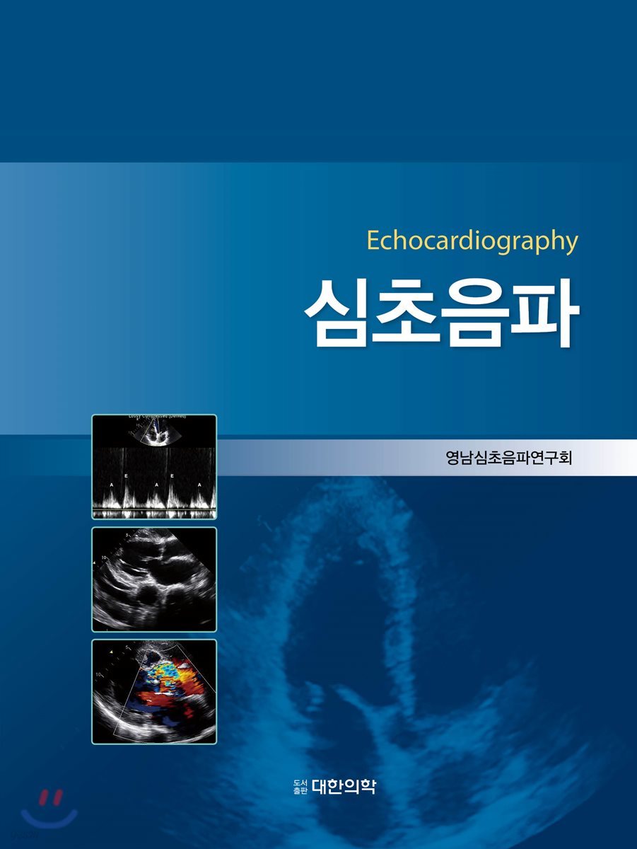 심초음파-Echocardiography 