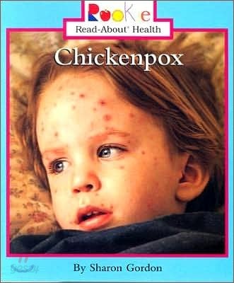 Chickenpox