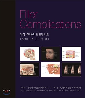 필러 부작용의 진단과 치료