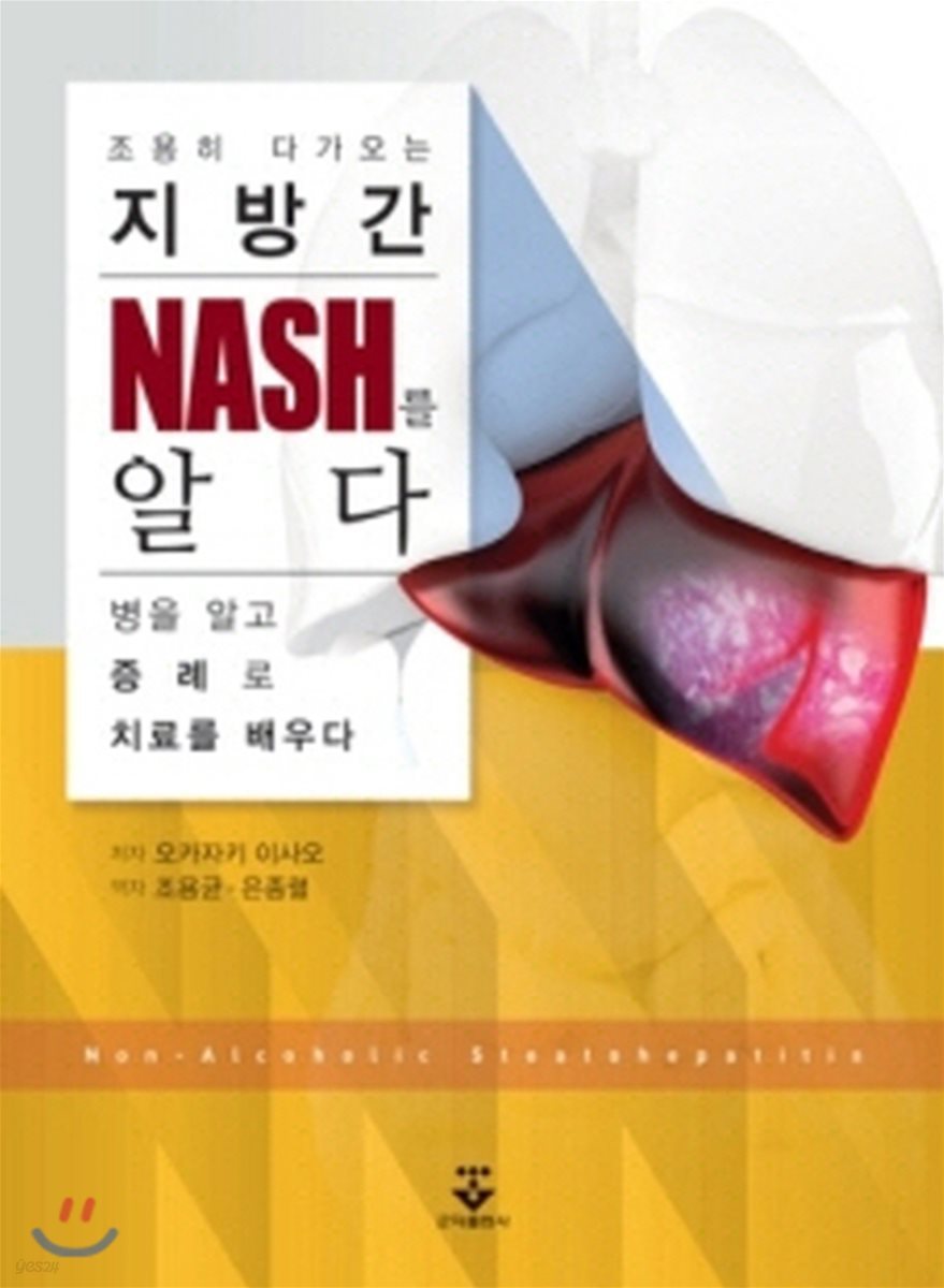 지방간 NASH를 알다