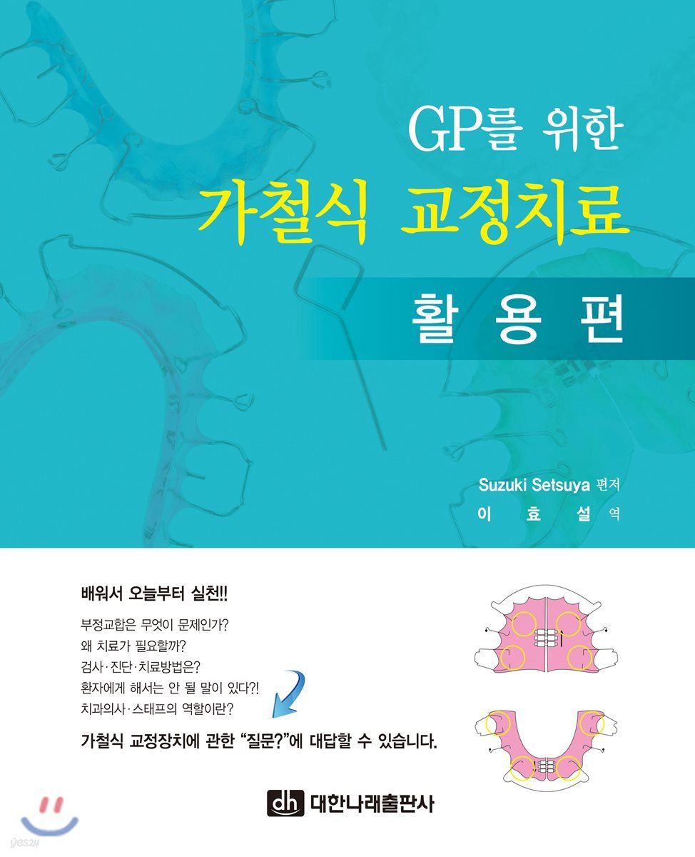 GP를 위한 가철식 교정치료-활용편