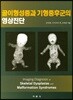 골이형성증과 기형증후군의 영상진단