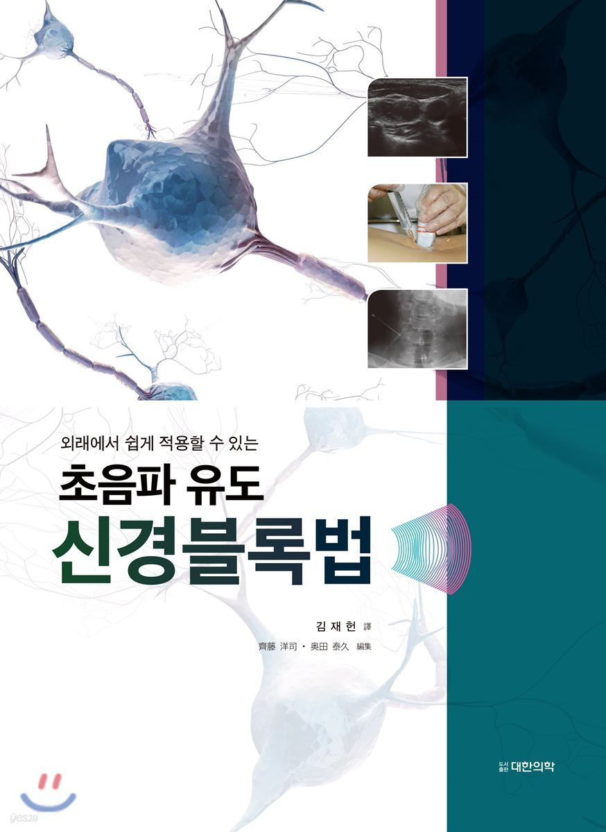 초음파 유도 신경블록법